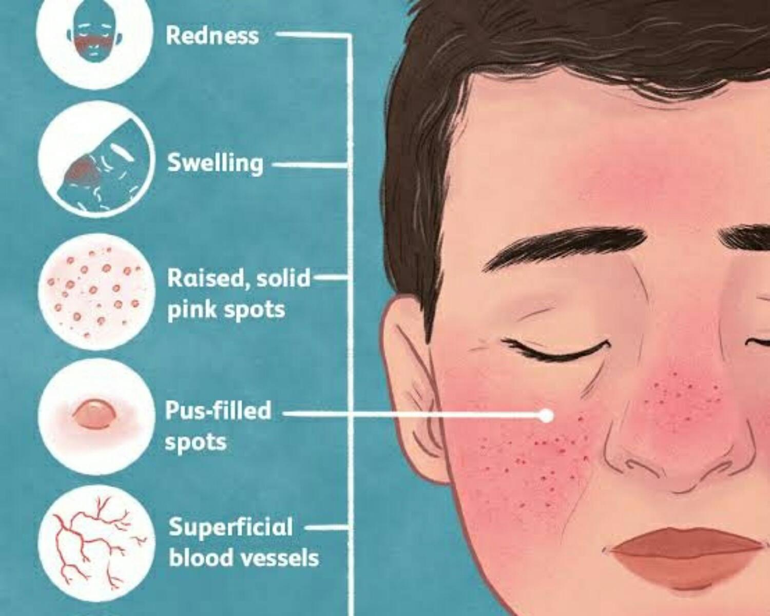 Other common mask skin problems: