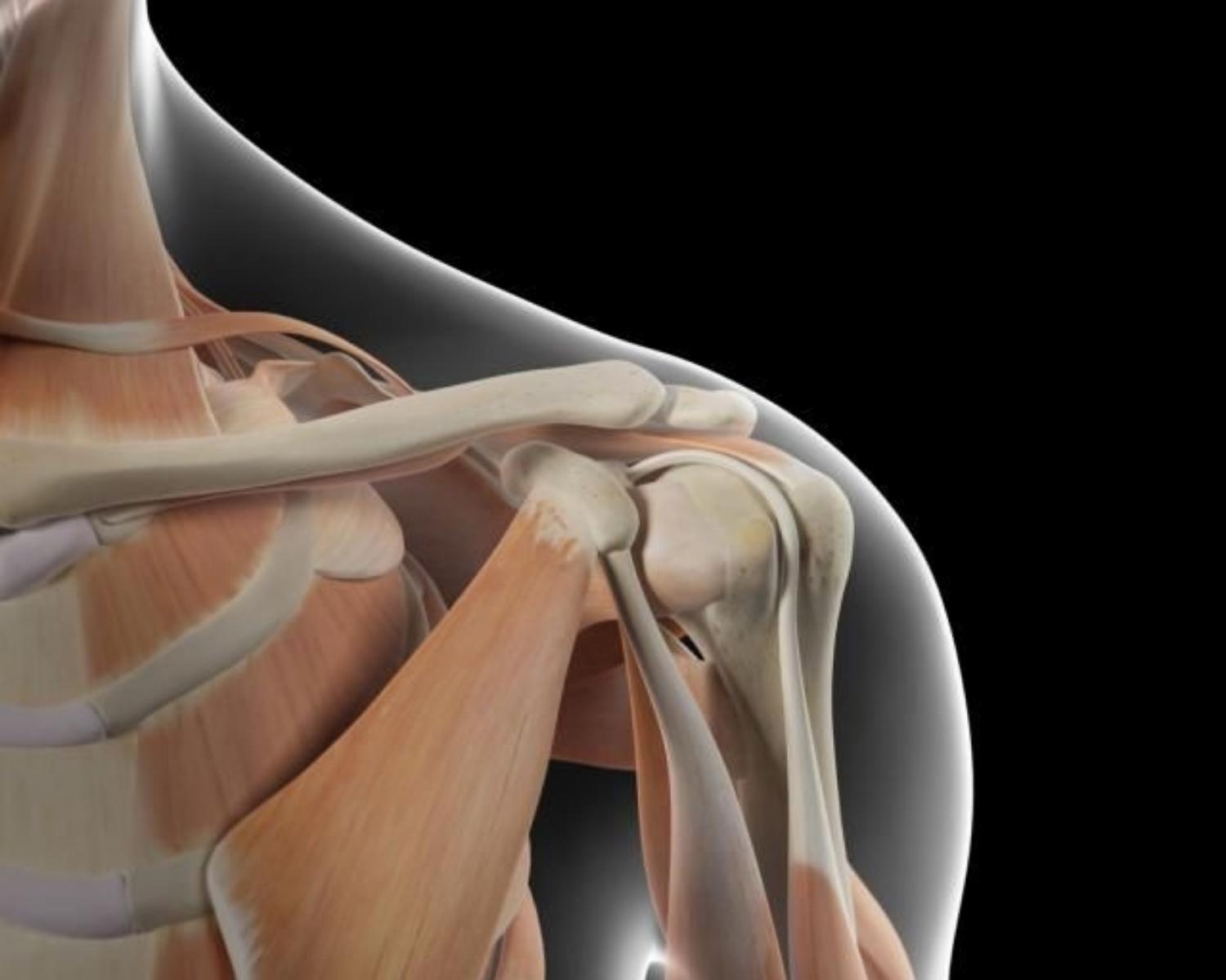 Bones : 