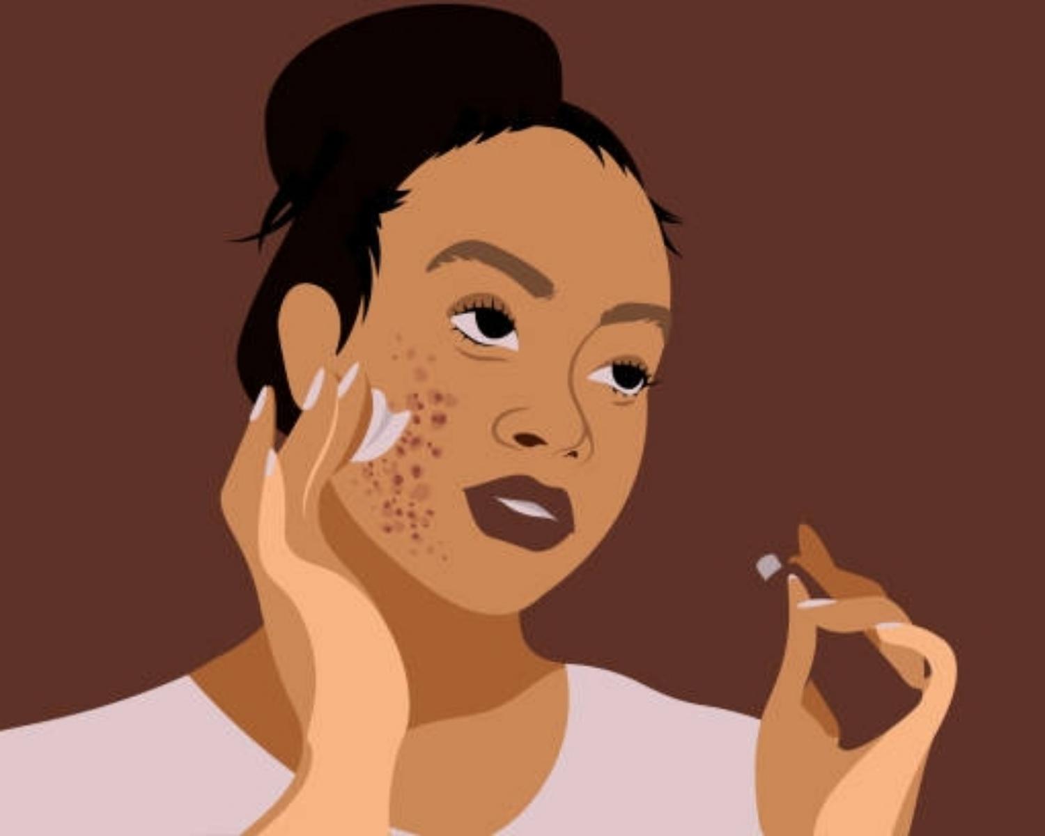 Breakouts