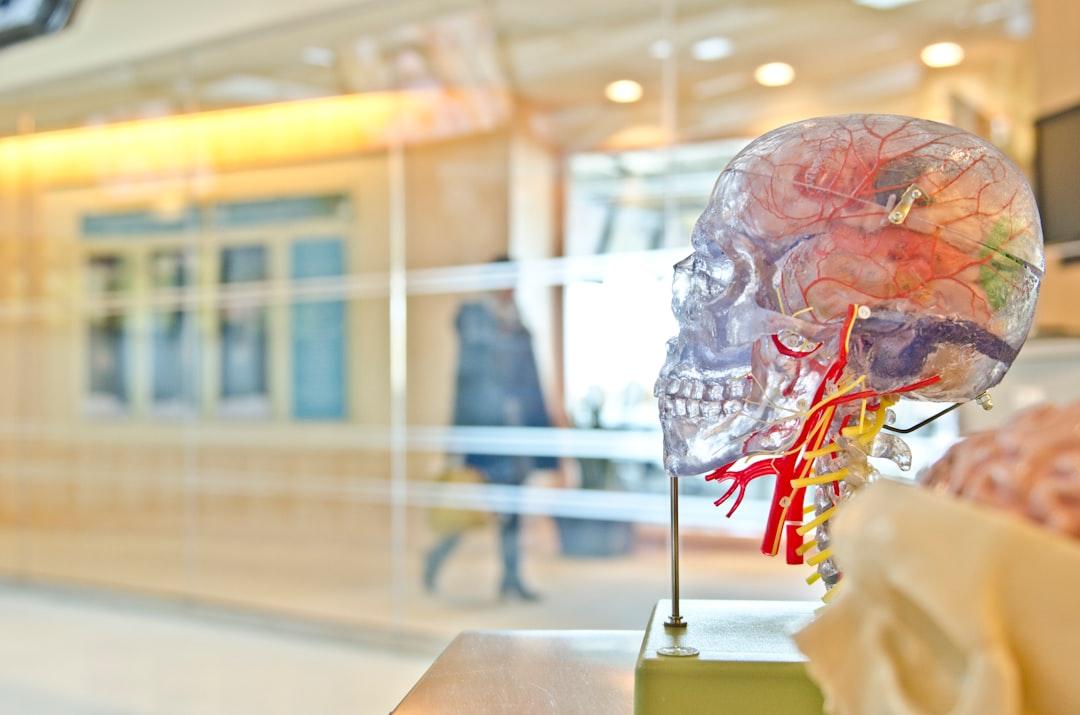Every Brain Is Unique